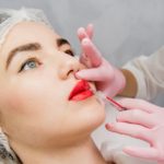 Como funciona o preenchimento labial – Tipos e cuidados