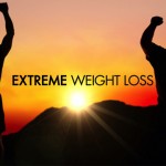 Extreme Weight loss