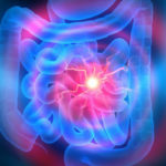 Deficiência de Lactase na Mucosa Intestinal - O Que é e Como Tratar