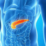 Dieta para Pancreatite - Alimentos e Dicas