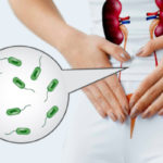 O Que é Infecção Urinária? Cuidados e Dicas