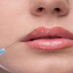 Botox na Boca - Para Que Serve, Riscos, Cuidados e Dicas