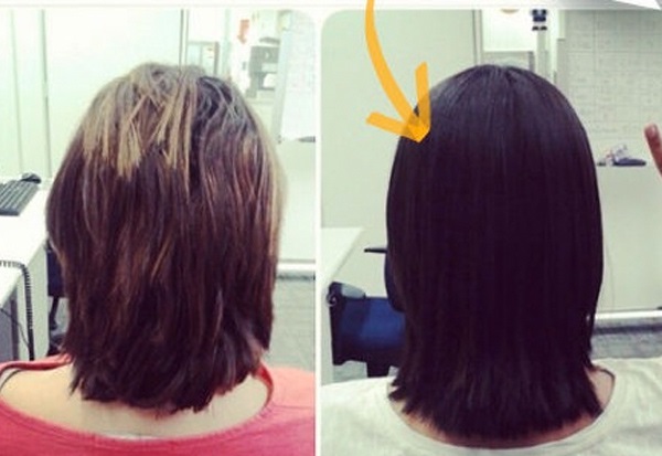 Antes e depois Imecap Hair