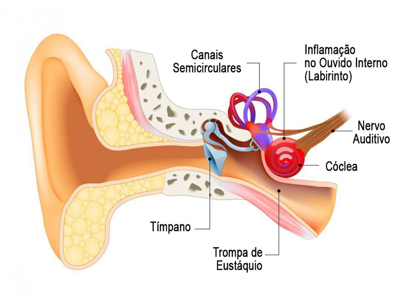 Estrutura interna do ouvido - labirintite