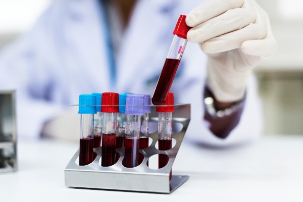 sangue para exame de albumina