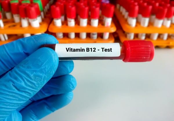 Vitamina B12 - Anemia perniciosa