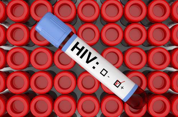 Tubo de frasco de teste de sangue com resultado positivo para HIV